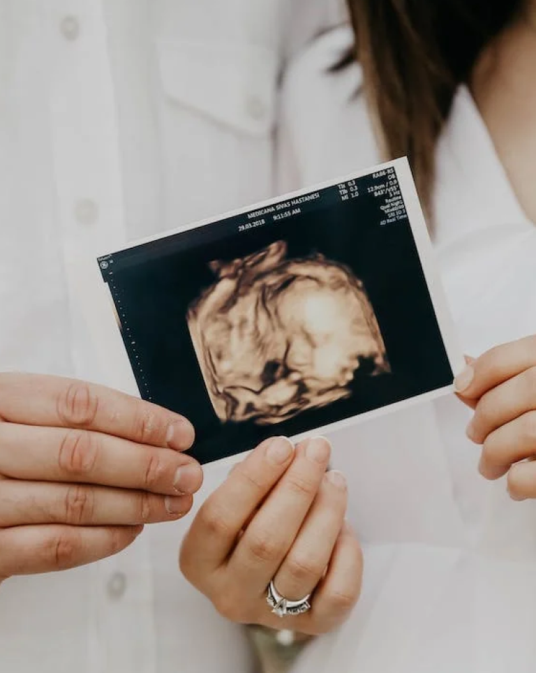 Pregnancy ultrasound - Dr Chang Singapore