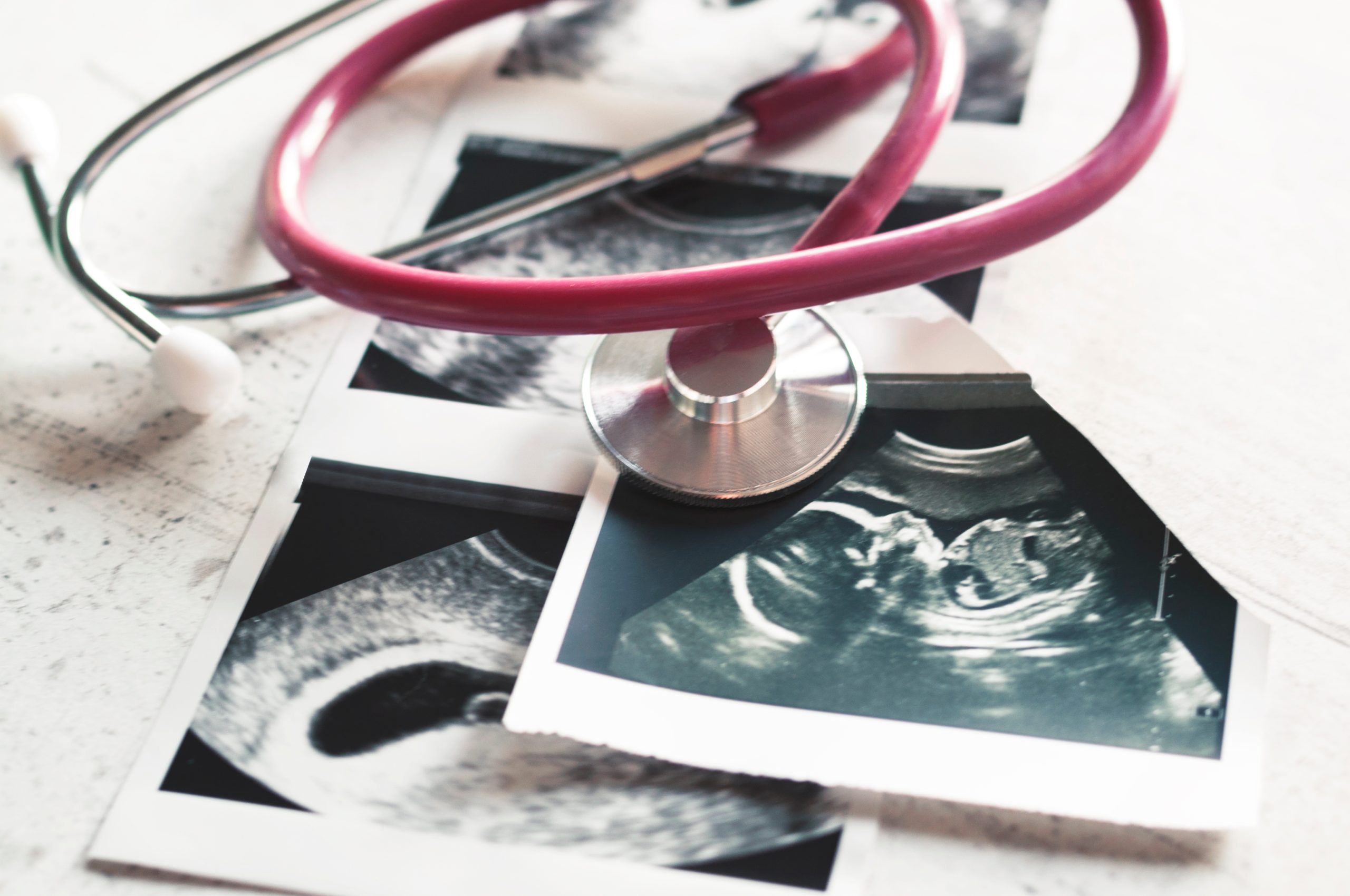 High-risk pregnancy: 6 questions to ask your doctor