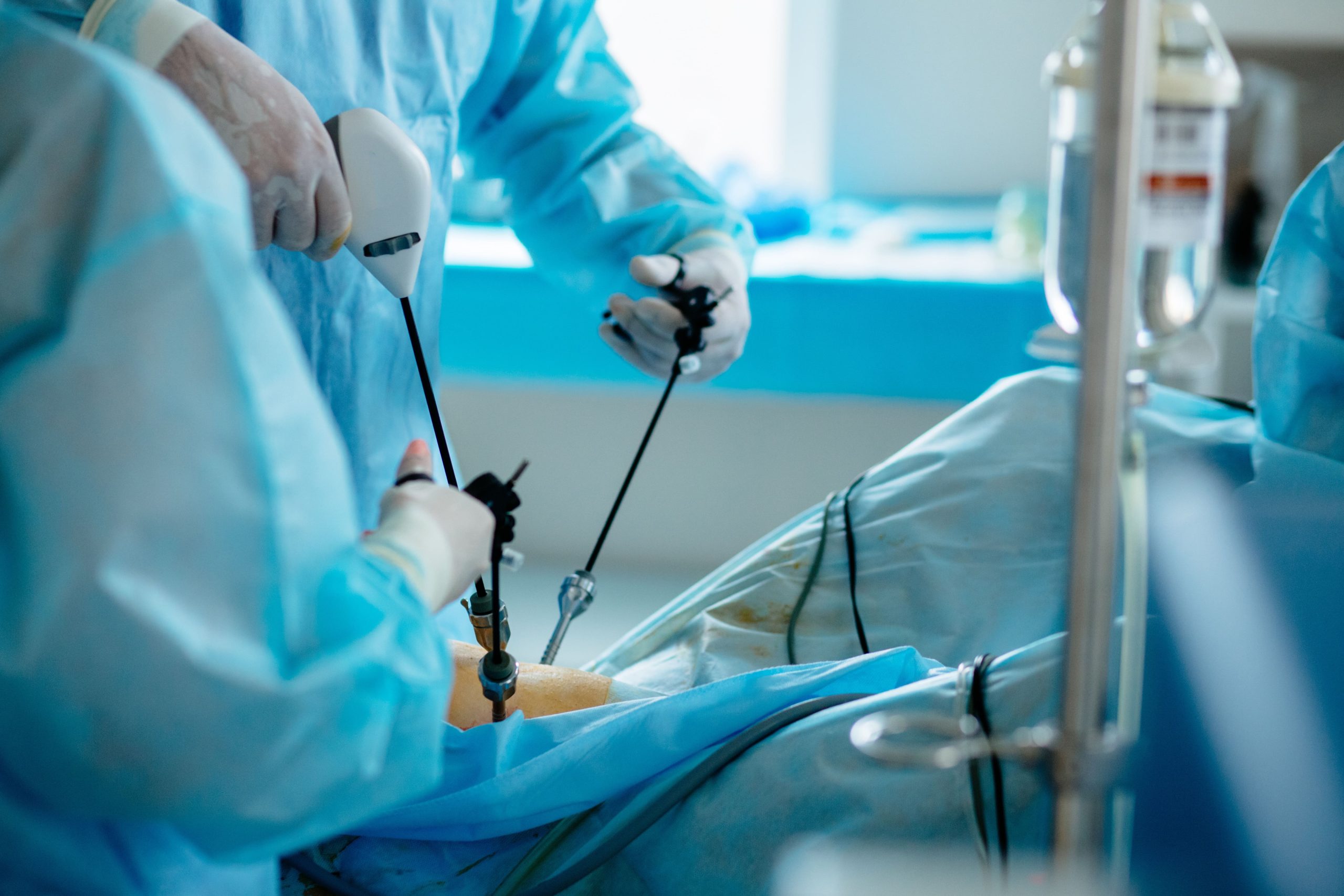 laparoscopic surgery uterus fibroids