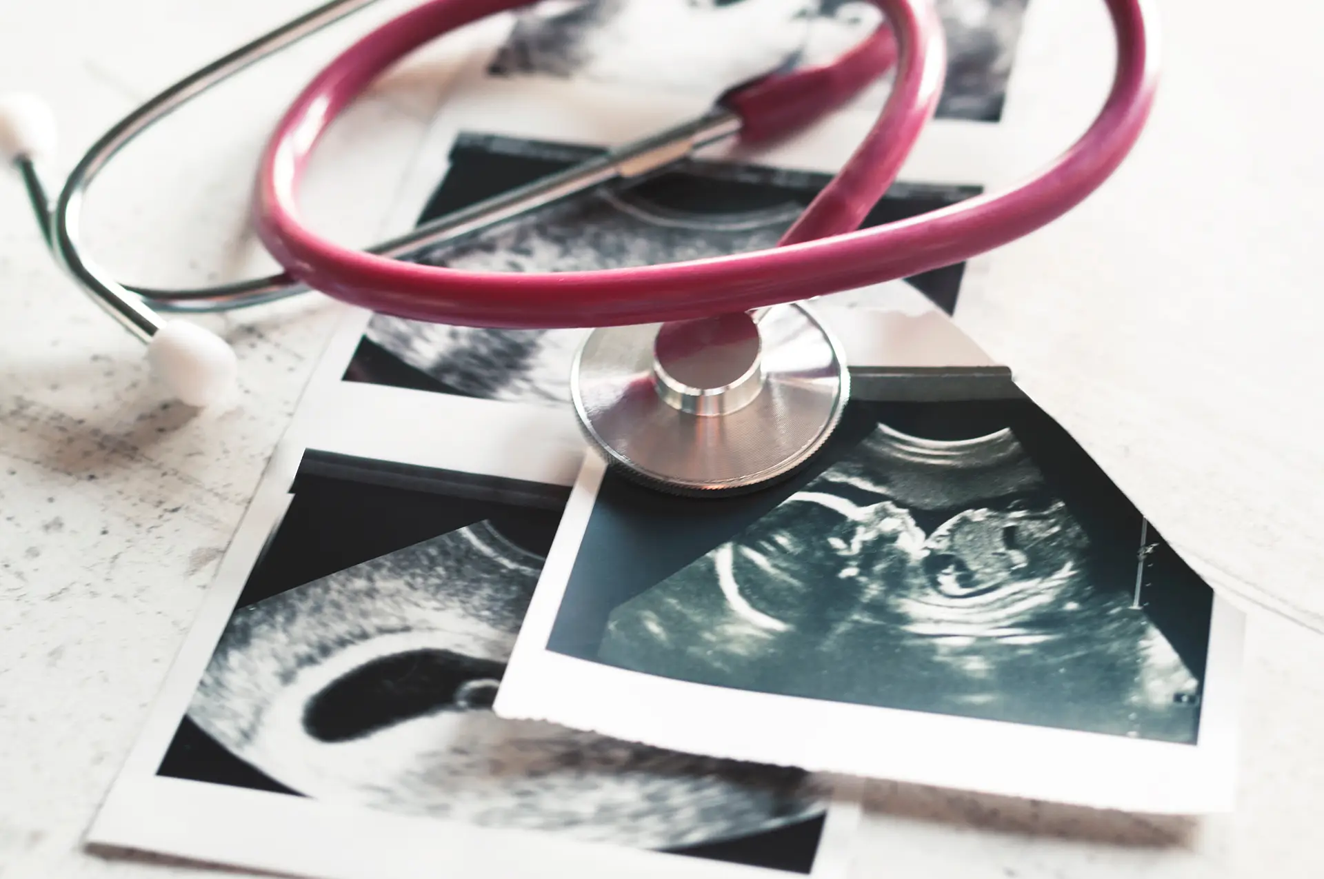 Pregnancy ultrasound images - Dr TC Chang