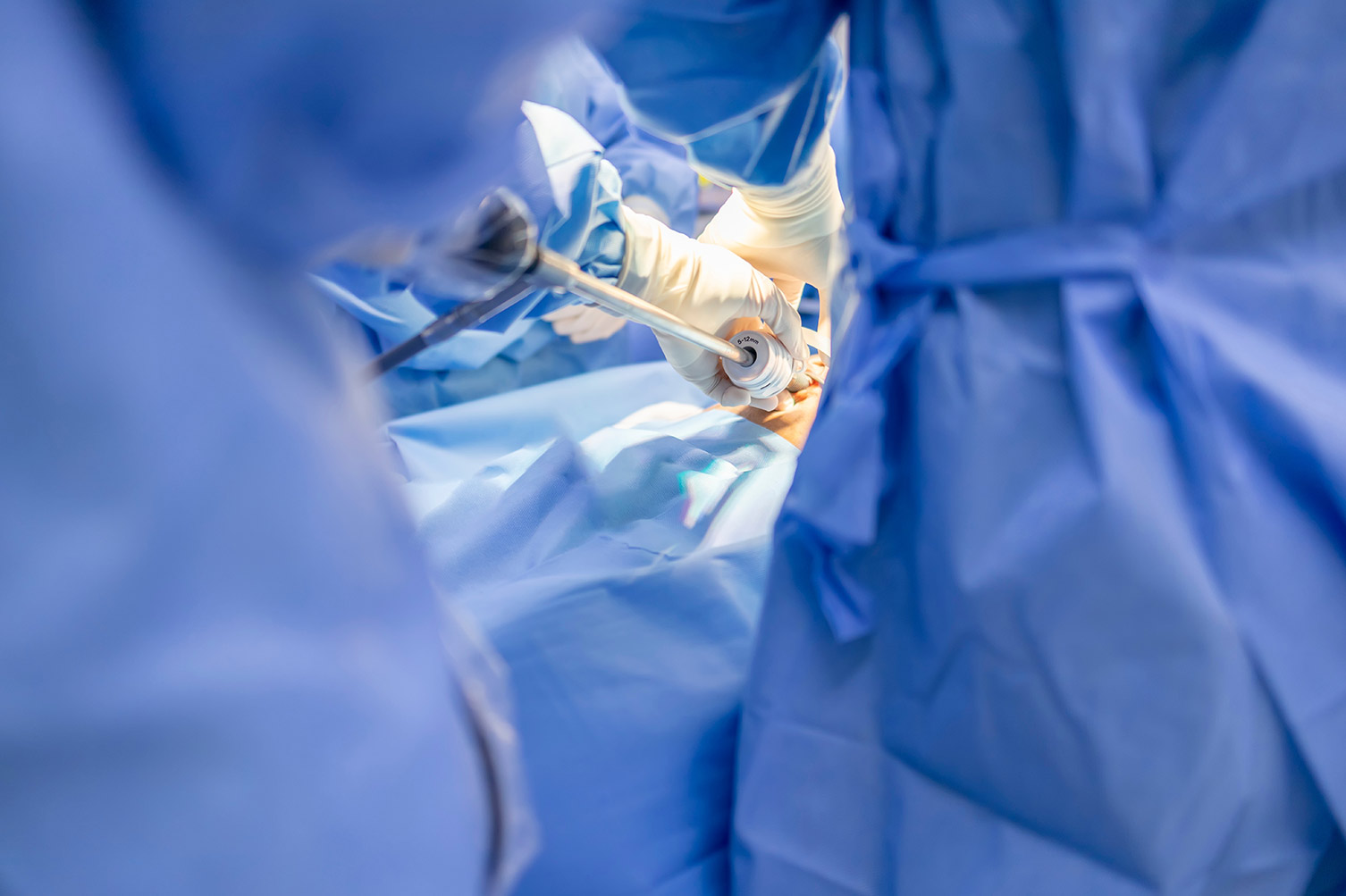 diagnostic laparoscopy for pelvic pain - Dr TC Chang