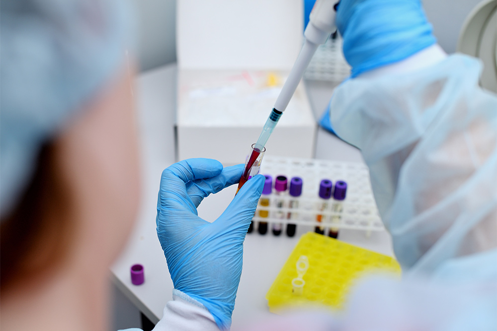 prenatal screening blood tests to determine conditions - Dr TC Chang